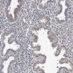 Immunohistochemical staining of human endometrium shows weak positivity in nuclear membrane in glandular cells.