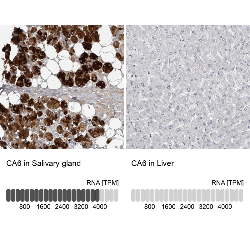 Anti-CA6 Antibody