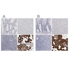 Immunohistochemical staining of human gastrointestinal, liver, lymphoid tissues and salivary gland using Anti-CA6 antibody HPA028692 (A) shows similar protein distribution across tissues to independent antibody HPA028550 (B).