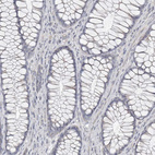 Immunohistochemical staining of human colon shows no positivity in glandular cells as expected.