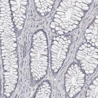 Immunohistochemical staining of human colon shows no positivity in glandular cells as expected.