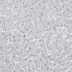 Immunohistochemical staining of human liver shows no positivity in hepatocytes as expected.
