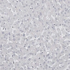 Immunohistochemical staining of human liver shows no positivity in hepatocytes as expected.