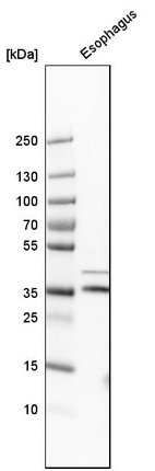 Western blot analysis in human esophagus tissue.