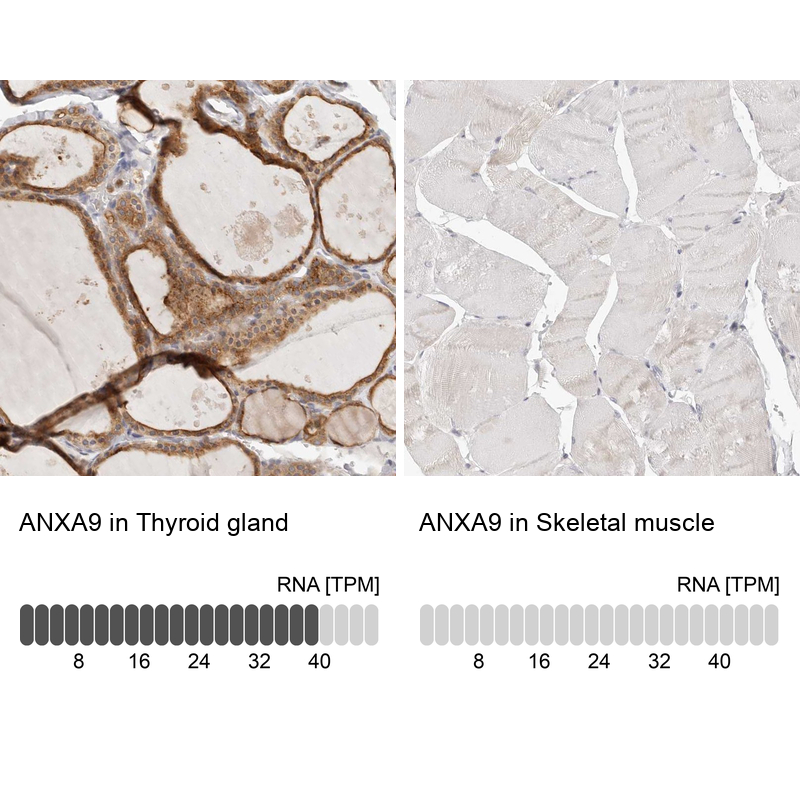 Anti-ANXA9 Antibody