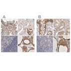 Immunohistochemical staining of human colon, kidney, lymph node and thyroid gland using Anti-ANXA9 antibody HPA028698 (A) shows similar protein distribution across tissues to independent antibody HPA028404 (B).