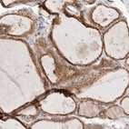 Immunohistochemical staining of human thyroid gland shows high expression.