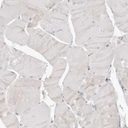 Immunohistochemical staining of human skeletal muscle shows low expression as expected.