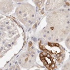 Anti-ANXA9 Antibody