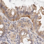 Immunohistochemical staining of human colon using Anti-ANXA9 antibody HPA028698.