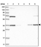 Lane 1: Marker [kDa] 230, 130, 95, 72, 56, 36, 28, 17, 11_br/_Lane 2: Human cell line RT-4_br/_Lane 3: Human cell line U-251MG sp_br/_Lane 4: Human plasma (IgG/HSA depleted)_br/_Lane 5: Human liver tissue_br/_Lane 6: Human tonsil tissue