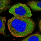 Immunofluorescent staining of human cell line A-431 shows localization to cytosol.