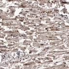 Immunohistochemical staining of human heart muscle shows moderate cytoplasmic positivity in cardiomyocytes.