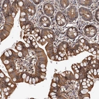 Immunohistochemical staining of human small intestine shows strong cytoplasmic positivity in glandular cells.