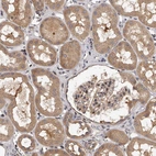 Immunohistochemical staining of human kidney shows moderate cytoplasmic positivity in cells in tubules.