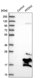 Western blot analysis in control (vector only transfected HEK293T lysate) and PFDN2 over-expression lysate (Co-expressed with a C-terminal myc-DDK tag (~3.1 kDa) in mammalian HEK293T cells, LY415791).