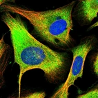 Immunofluorescent staining of human cell line U-2 OS shows localization to cytosol.