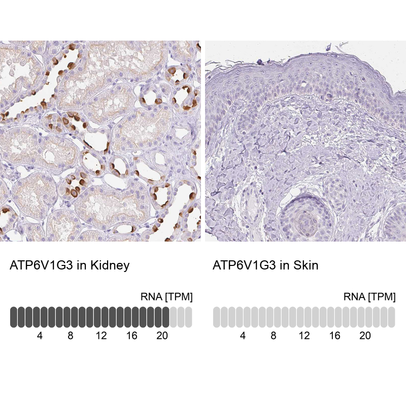 Anti-ATP6V1G3 Antibody