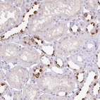 Immunohistochemical staining of human Kidney shows strong cytoplasmic positivity in cells in distal tubules.