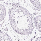 Immunohistochemical staining of human Testis shows no positivity in cells in seminiferous ducts as expected.