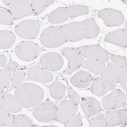 Immunohistochemical staining of human Skeletal muscle shows no positivity in myocytes as expected.