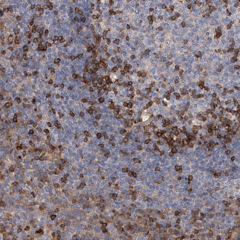 Anti-IPCEF1 Antibody