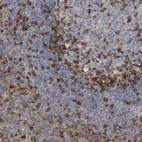 Anti-IPCEF1 Antibody