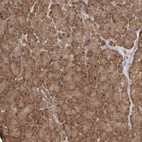 Anti-RWDD1 Antibody