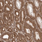 Immunohistochemical staining of human stomach shows moderate cytoplasmic positivity in glandular cells.