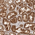 Immunohistochemical staining of human kidney shows strong granular cytoplasmic positivity in cells in tubules.