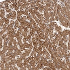 Immunohistochemical staining of human liver shows moderate granular cytoplasmic positivity in hepatocytes.