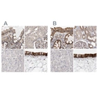 Anti-UFC1 Antibody