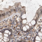 Immunohistochemical staining of human colon using Anti-UFC1 antibody HPA028722.