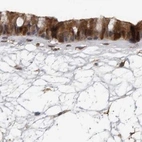 Immunohistochemical staining of human nasopharynx using Anti-UFC1 antibody HPA028722.