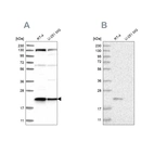 Western blot analysis using Anti-UFC1 antibody HPA028722 (A) shows similar pattern to independent antibody HPA027481 (B).