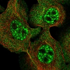 Immunofluorescent staining of human cell line A-431 shows localization to nuclear speckles & cytosol.