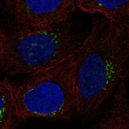 Anti-RGS18 Antibody