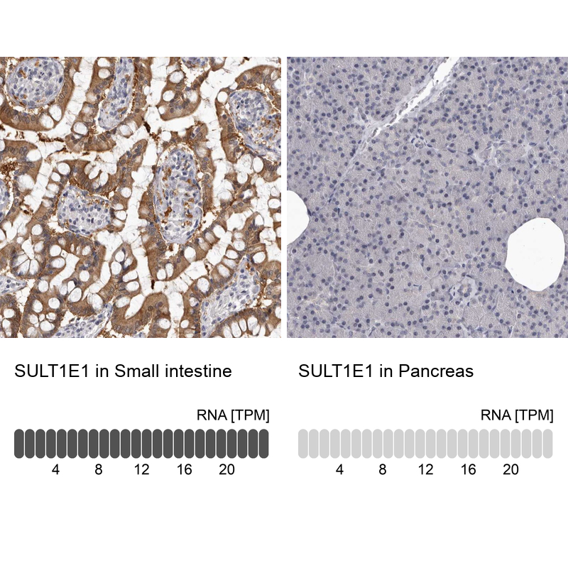 Anti-SULT1E1 Antibody