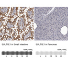 Anti-SULT1E1 Antibody