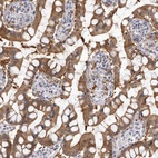 Anti-SULT1E1 Antibody