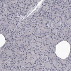 Anti-SULT1E1 Antibody