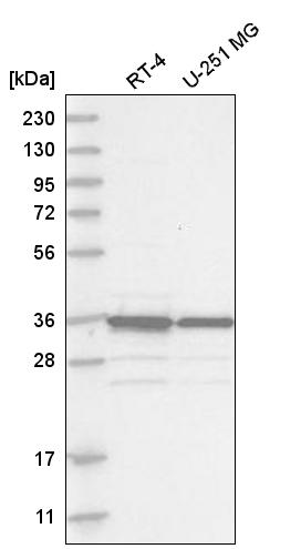 Anti-MAD2L1BP Antibody