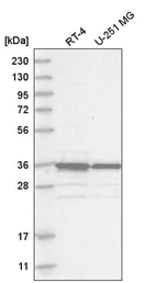 Anti-MAD2L1BP Antibody