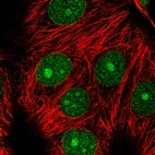 Immunofluorescent staining of human cell line MCF7 shows localization to nucleus, nucleoli & nuclear membrane.