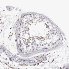 Immunohistochemical staining of human testis shows weak cytoplasmic positivity in a subset of cells in seminiferous ducts.