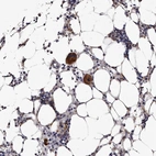 Immunohistochemical staining of human bone marrow shows strong cytoplasmic positivity in megakaryocytes.