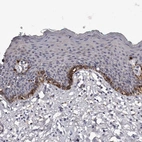 Immunohistochemical staining of human skin shows strong cytoplasmic positivity in squamous epithelial cells.