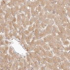 Anti-PPP1R3B Antibody