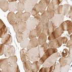 Immunohistochemical staining of human skeletal muscle shows moderate to strong cytoplasmic positivity in striated muscle fibers.
