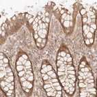 Immunohistochemical staining of human rectum shows moderate cytoplasmic positivity in glandular cells.